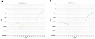 Increased Salivary microRNAs That Regulate DJ-1 Gene Expression as Potential Markers for Parkinson’s Disease